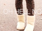 uggseriously